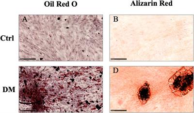 Micro-fragmented and nanofat adipose tissue derivatives: In vitro qualitative and quantitative analysis